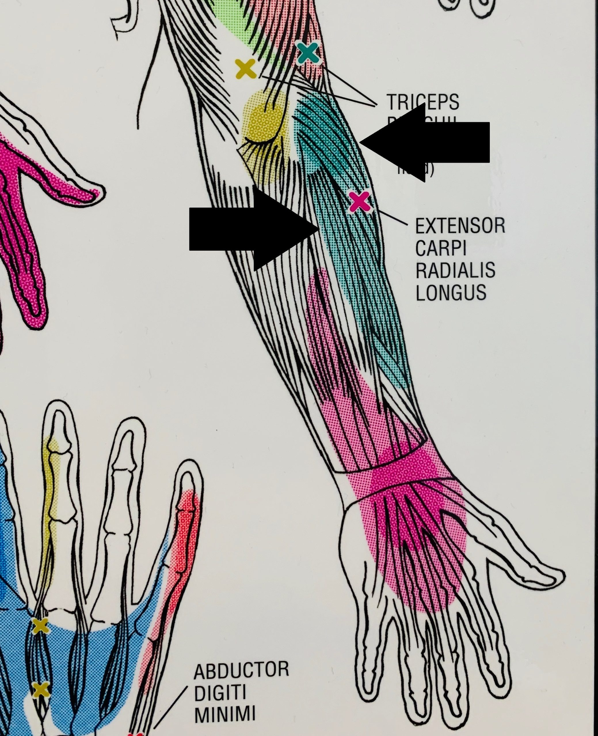 tennis elbow pain location