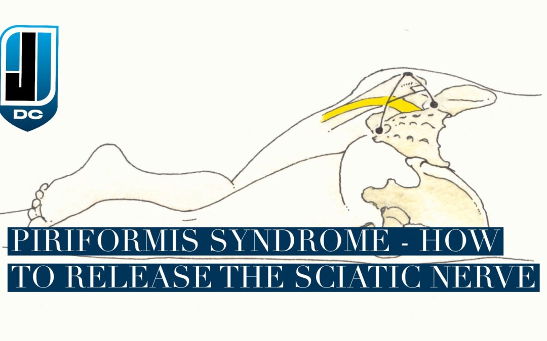 How to Release the Sciatic Nerve in Piriformis Syndrome