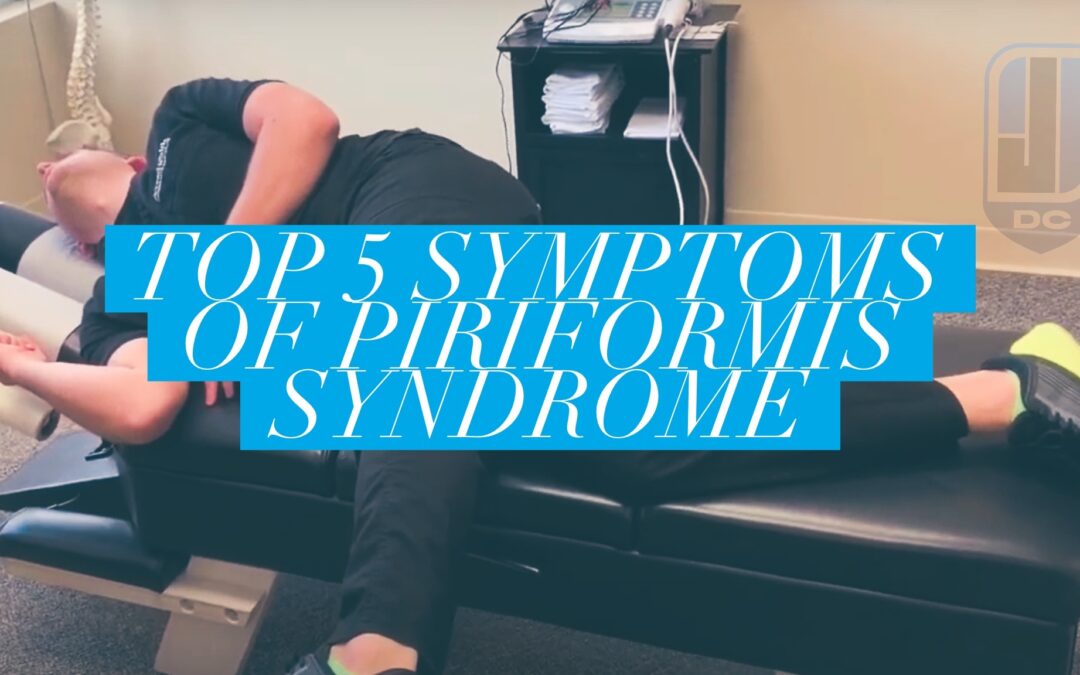 piriformis syndrome symptoms